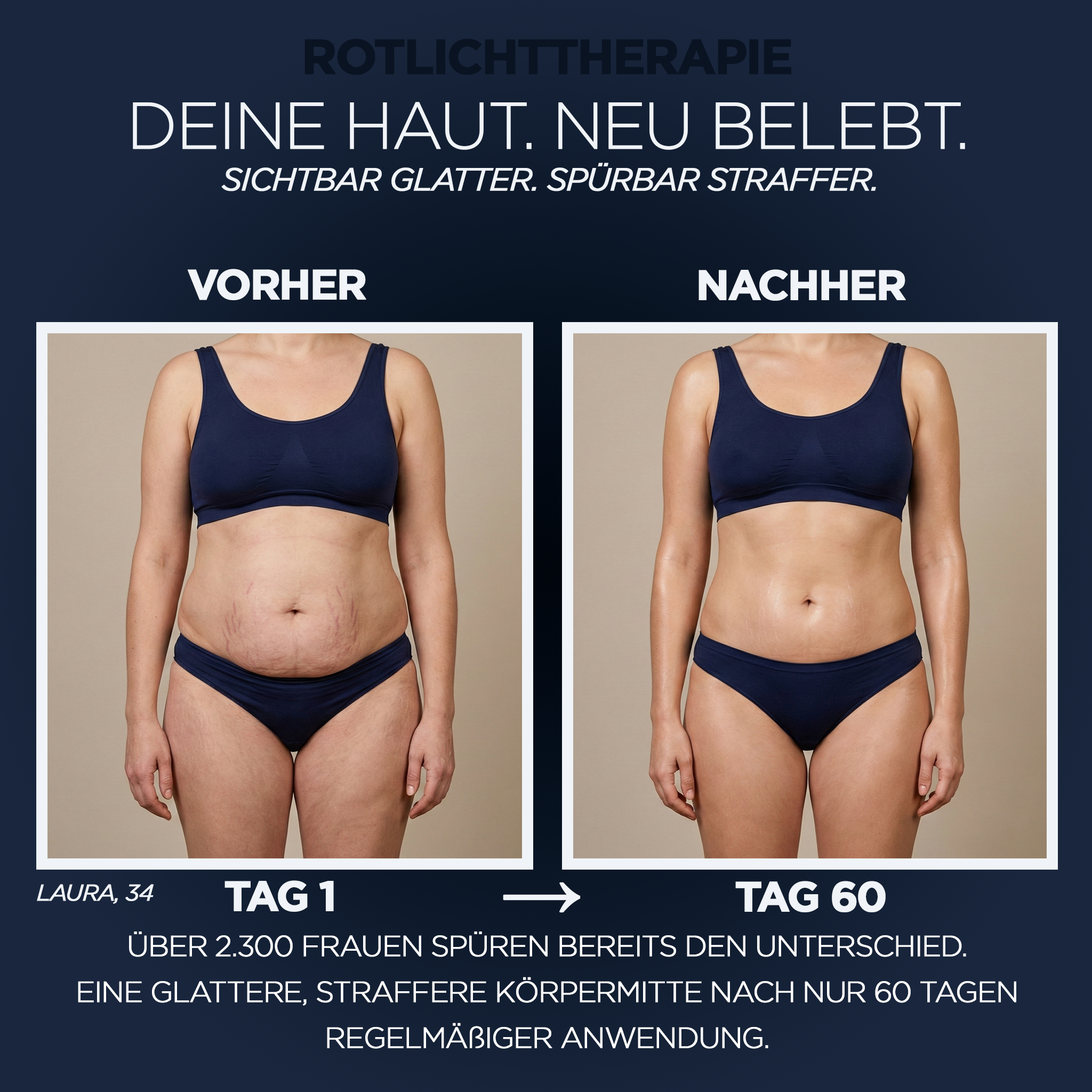 Nexora Belt™ Rotlicht-Therapie für Dehnungsstreifen